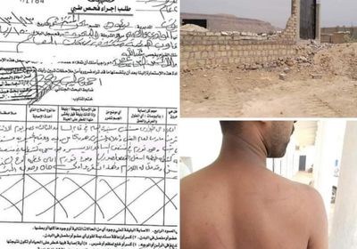 قوة إخوانية تعتدي على 4 مواطنين وتهدم منشأتهم العقارية بتريم