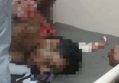 عدوان حوثي إرهابي يخلف شهيدين و4 مصابين في كرش