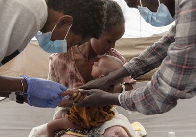 دراسة جديدة تكشف وفاة 1329 شخصًا في تيغراي بسبب الجوع