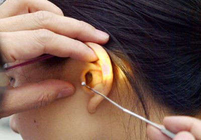 شركة تبتكر علاجا جينيا يعيد السمع لطفل أصم في أمريكا