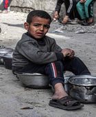مسؤول أمريكي: خطر المجاعة شديد جدا في غزة