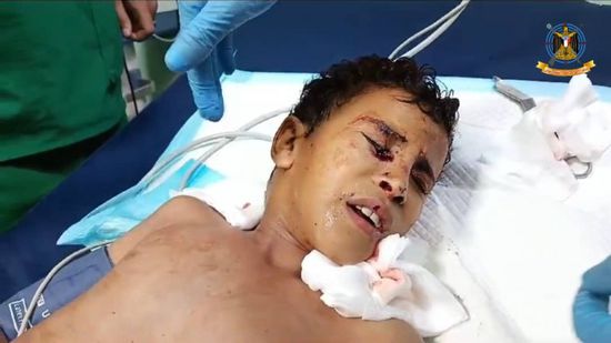 قناص حوثي يصيب طفلا برصاصة في الرأس شمال الضالع