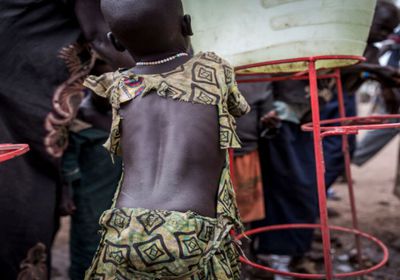 جنوب السودان.. وفاة أكثر من 70 شخصاً بسبب الكوليرا خلال أسبوع