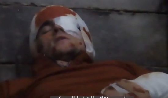 القسام تنشر فيديو جديد لرهينة إسرائيلي جريح في غزة