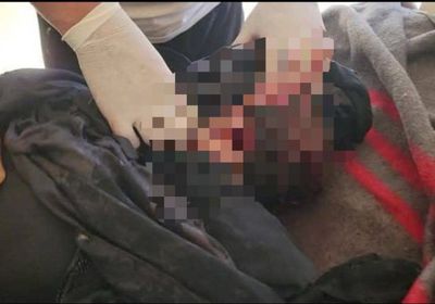 استشهاد أم برصاص قناص حوثي على أطراف الحد