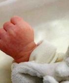 حالة نادرة..  ولادة طفل بوجهين في أربيل