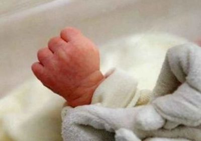 حالة نادرة..  ولادة طفل بوجهين في أربيل