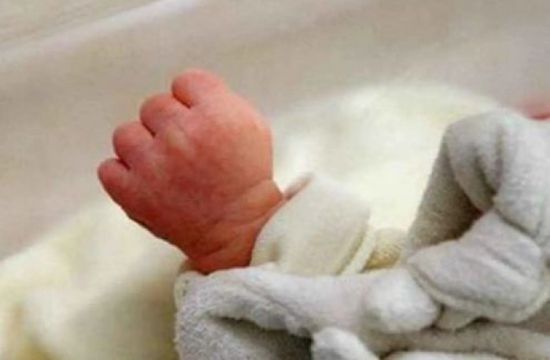 حالة نادرة..  ولادة طفل بوجهين في أربيل