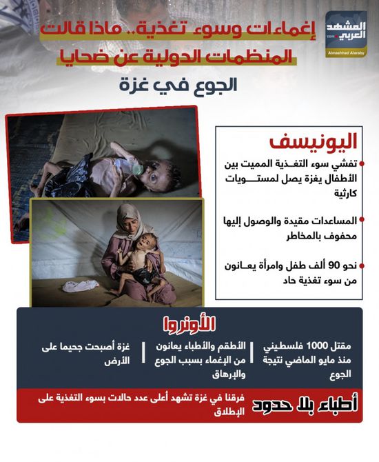 إغماءات وسوء تغذية.. ماذا قالت المنظمات الدولية عن ضحايا الجوع في غزة؟ (إنفوجراف)