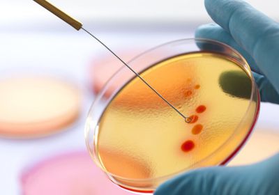 ذكاء اصطناعي يكتشف مضادات حيوية جديدة