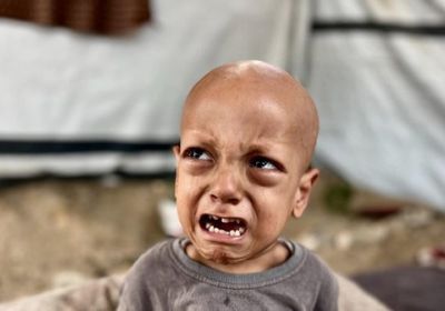 وفاة الطفل الفلسطيني صاحب مقولة "أنا جعان"