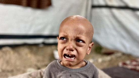 وفاة الطفل الفلسطيني صاحب مقولة "أنا جعان"