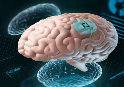 "نيورالينك" تبدأ تجارب لتحويل الأفكار إلى نصوص