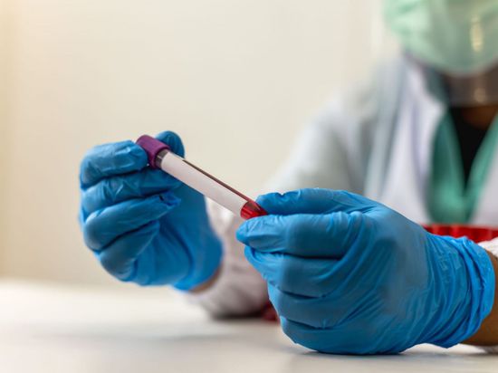 علماء روس يبتكرون تقنية تعزز فعالية علاج سرطان الدم ثمانية أضعاف