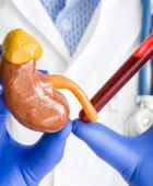 دراسة: تحليل دم جديد يتنبأ بدقة أكبر بتطور أمراض الكلى