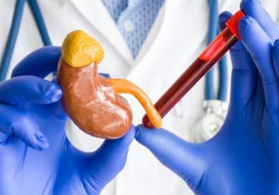 دراسة: تحليل دم جديد يتنبأ بدقة أكبر بتطور أمراض الكلى