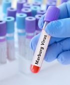 إثيوبيا تعلن تفشي وباء "ماربورغ" جنوب البلاد