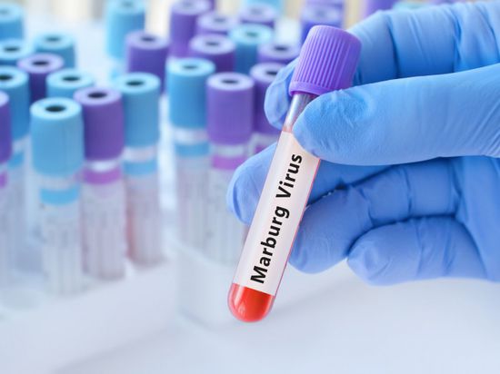 إثيوبيا تعلن تفشي وباء "ماربورغ" جنوب البلاد