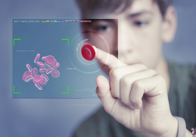 نموذج ذكاء اصطناعي لتحديد مسببات الأمراض النادرة