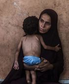 الأمم المتحدة: انتهاء حالة المجاعة في غزة