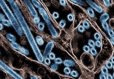 أنفلونزا جديدة تتفشى في لبنان