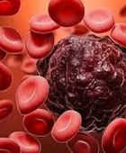 ابتكار علاج جديد لسرطان الدم دون الإضرار بالمناعة