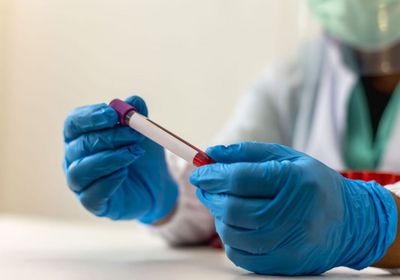 علماء ينجحون في تصنيع مركب فطري واعد ضد السرطان