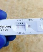 إثيوبيا تعلن انتهاء تفشي فيروس ماربورغ بعد 42 يومًا دون إصابات جديدة