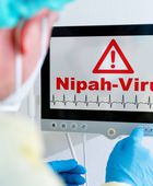 سنغافورة تعزز إجراءات الفحص الصحي بمطار تشانغي بعد تفشي فيروس نيباه