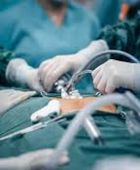 لأول مرة.. رئة صناعية تبقي مريضا على قيد الحياة 48 ساعة