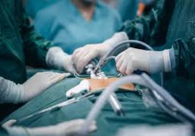 لأول مرة.. رئة صناعية تبقي مريضا على قيد الحياة 48 ساعة