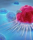 دراسة: وفاة مرضى سرطان بأسرع من المتوقع في أوائل جائحة كوفيد-19