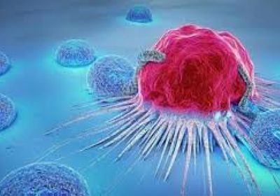 دراسة: وفاة مرضى سرطان بأسرع من المتوقع في أوائل جائحة كوفيد-19