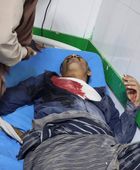 4 شهداء من المتظاهرين بنيران القوات المدعومة سعوديا في شبوة