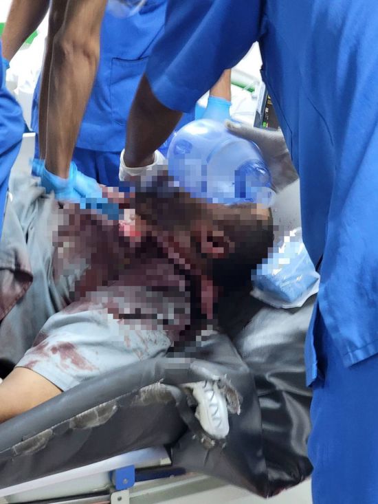 مصدر طبي: 4 شهداء و28 جريحا في عتق بنيران الأمن