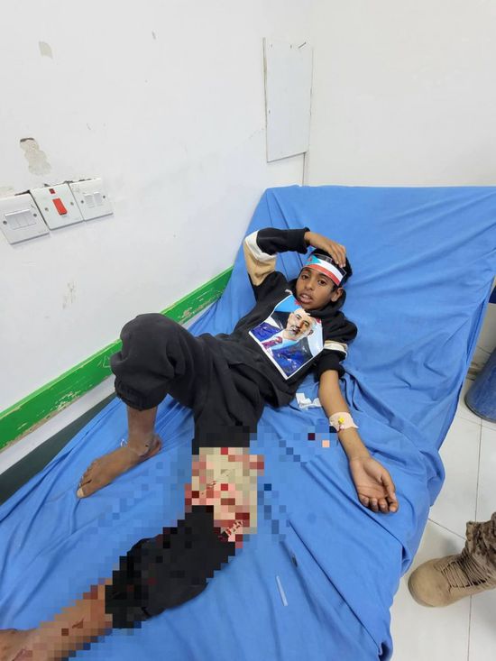 قمع متظاهري عتق في فعالية يوم الشهيد السلمية.. إرهاب يمني برعاية سعودية