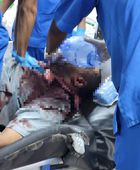 استشهاد المواطن حمزة العولقي بإطلاق نار مباشر في عتق