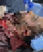 رصاص قوى الاحتلال في عتق يشعل جذوة التحرر الجنوبي