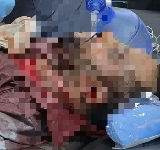 رصاص قوى الاحتلال في عتق يشعل جذوة التحرر الجنوبي