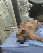 شهيد و20 جريحا حصيلة مجزرة معاشيق بنيران درع الوطن