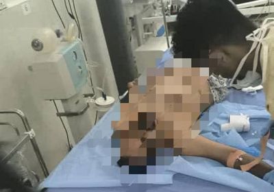 شهيد و20 جريحا حصيلة مجزرة معاشيق بنيران درع الوطن