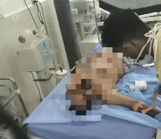 شهيد و20 جريحا حصيلة مجزرة معاشيق بنيران درع الوطن