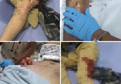 محاولة لتجريم تأييد المجلس الانتقالي.. حقيقة مرة وراء حملات القمع ضد الجنوب