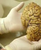 دراسة: شيخوخة الأمعاء تزيد من تدهور القدرات الإدراكية