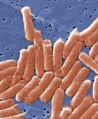 دراسة: بديل للمضادات الحيوية يمكنه القضاء على السالمونيلا الملوثة للأغذية