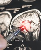 اكتشاف روسي جديد يفتح الطريق لتطوير أدوية لعلاج باركنسون