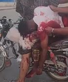 شهيد ثان برصاص القوات المدعومة سعوديا في المكلا