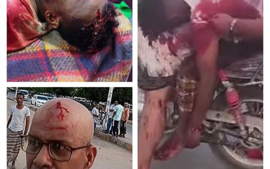 الشبكة المدنية تُدين "قمع" متظاهري المكلا وتطالب بتحقيق دولي