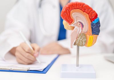 دواء تجريبي جديد يظهر فعالية بخفض تكرار السكتة الدماغية