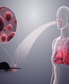 منظمة الصحة تقلل من تفشي هانتا 